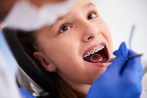 Best Braces Treatment in Malviya Nagar