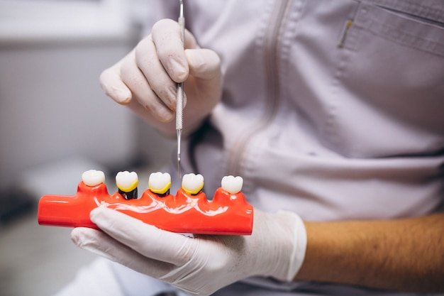 Best Dental Implant in New Delhi