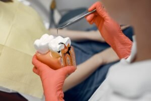 Best Root Canal Treatment in South Delhi