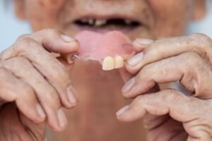Best Partial Denture in Malviya Nagar