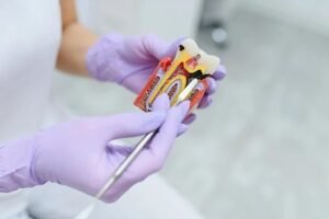 Best Root Canal Treatment in Malviya Nagar