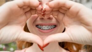 Best Orthodontic Wire Treatment in Malviya Nagar, South Delhi