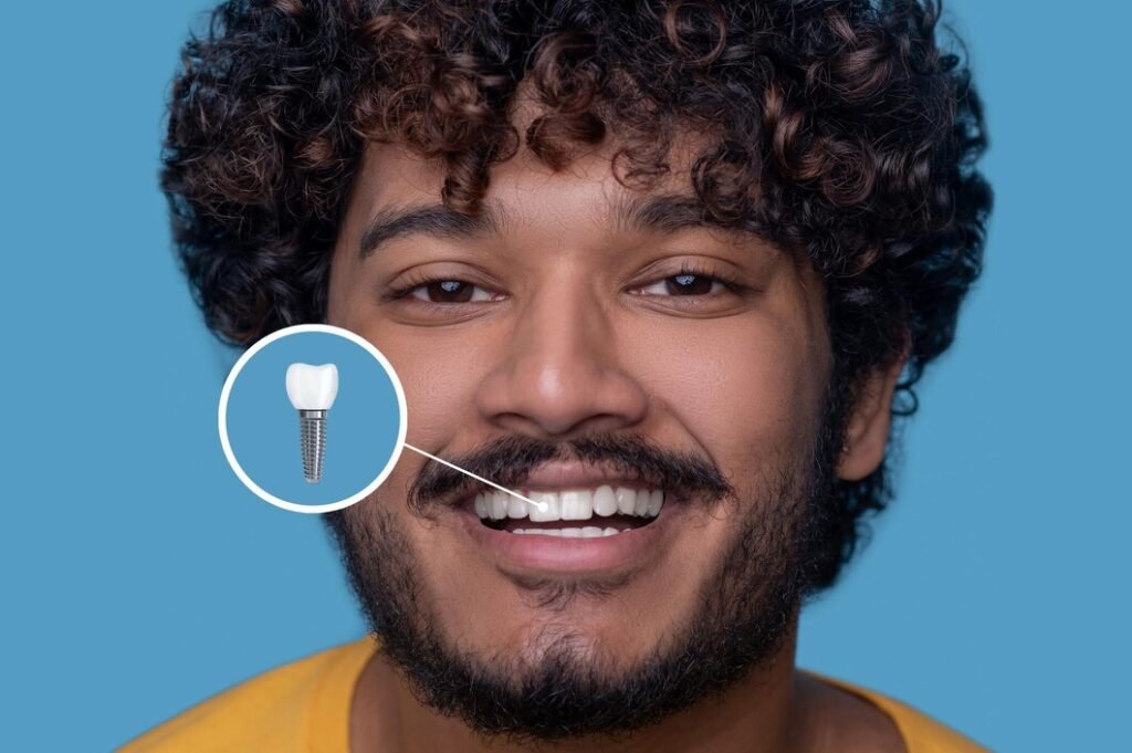 Best Dental implant treatment in Malviya Nagar, South Delhi
