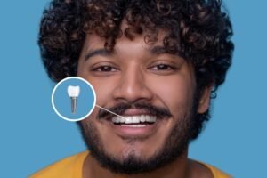 Best Dental implant treatment in Malviya Nagar, South Delhi