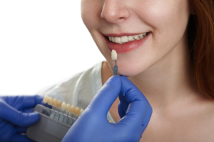 Best Dental Veneers Services in Lajpat Nagar