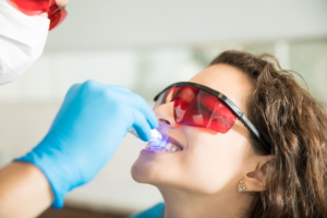 Best Teeth Whitening Services in Lajpat Nagar