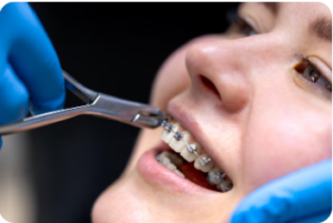 Best Orthodontist in Malviya Nagar