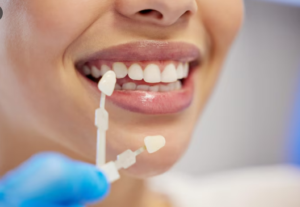 Best Dental Veneers in South Extension