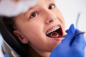 Best Teeth Braces Clinic in Defence Colony