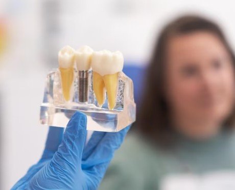 Best Dental Implant Centre in Lajpat Nagar