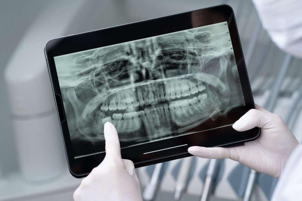 Best Dental Digital X-Ray in New Delhi