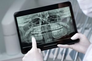 Best Dental Digital X-Ray in New Delhi