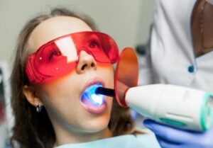 Best Laser Restoration Teeth in Defence Colony