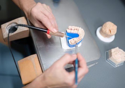 Best Teeth Bridge Service in Malviya Nagar