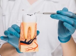 Best Root Canal Treatment in Malviya Nagar