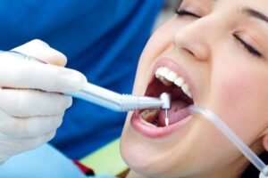 Best Scaling And Polishing Dental Treatment in Malviya Nagar